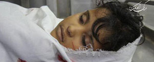 Gaza girl killed in civilian attacks. Photo courtesy: Hamas